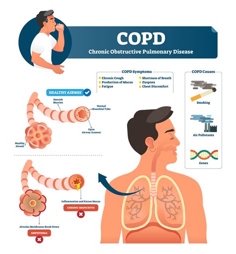 煞到呼吸不順|當呼吸變得不順暢時 (Understanding Lung Conditions) 